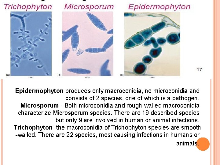 Có khoảng hơn 30 loài nấm gây bệnh nấm da chủ yếu thuộc các chi Trichophyton, Epidermophyton, Microsporum